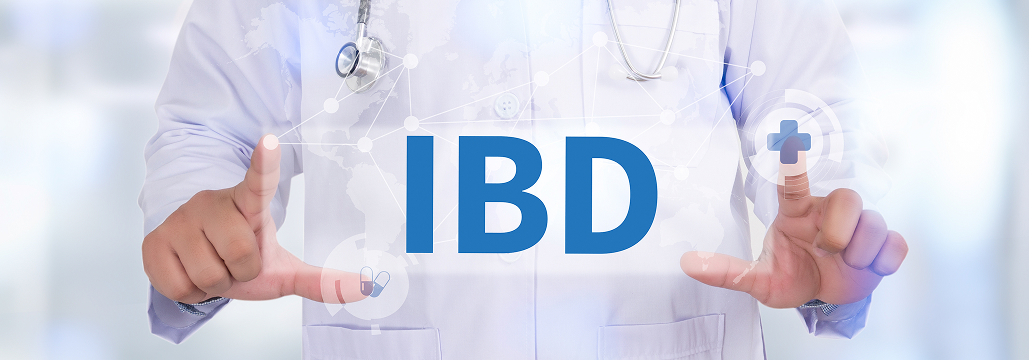 【Gut】喫煙がIBDの腸内免疫に与える影響のメカニズムを解明