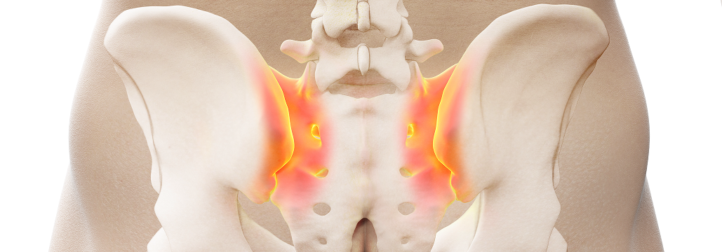 【Lancet Rheumatol】体軸性脊椎関節炎、イキセキズマブで仙腸関節の骨びらん減少