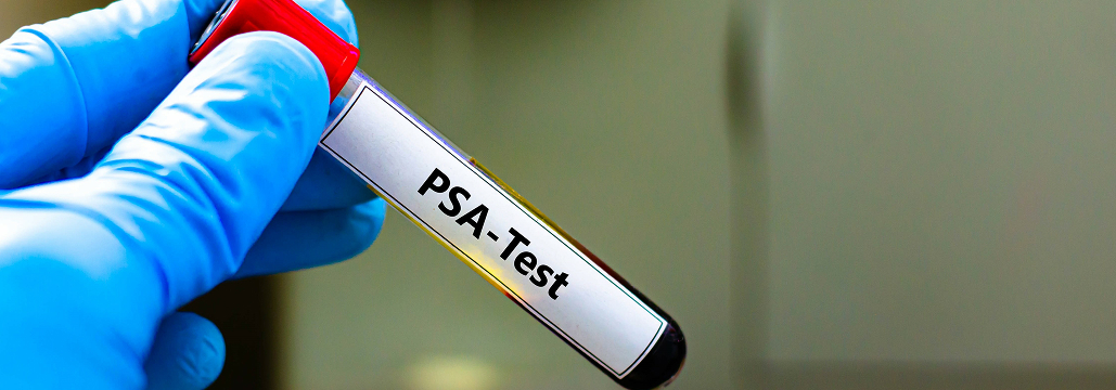 【Prostate】高リスク前立腺癌、RALP後PSA遷延は長期予後に影響せず