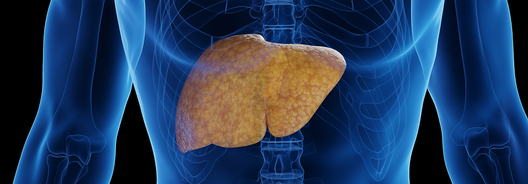 【Gut】MASHの新規バイオマーカー 「TSP2」 が高リスク患者の特定に有用