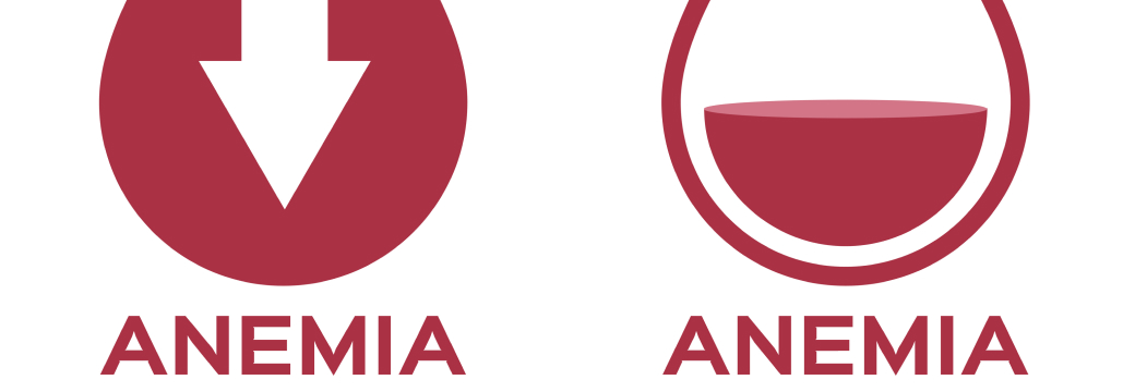 【NEJM】多剤抵抗性自己免疫性溶血性貧血へのCD19 CAR-T療法､ 全例で完全寛解