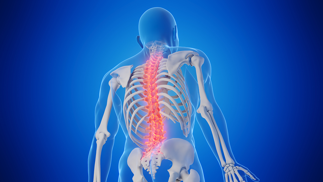 【Arthritis Rheum】新規JAK1阻害薬ivarmacitinibが活動性強直性脊椎炎で有望