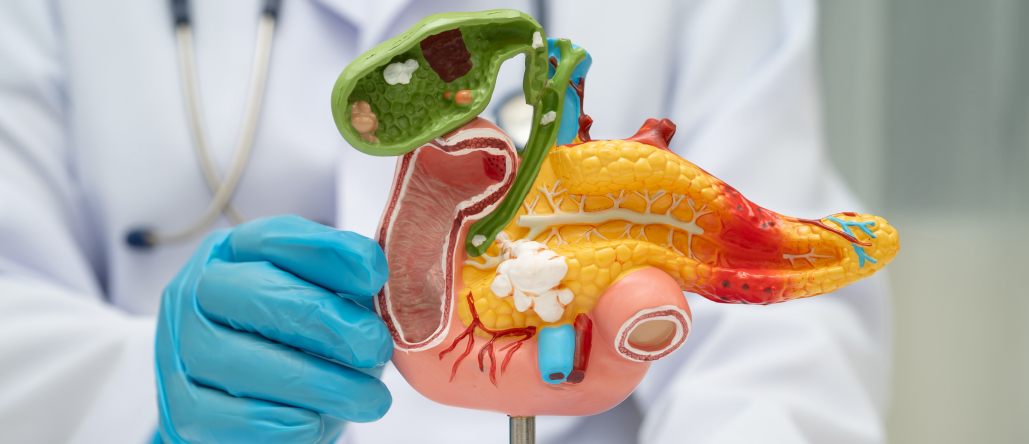 【JAMA Oncol】膵腺癌､ 術後補助化学療法のOS改善効果は？