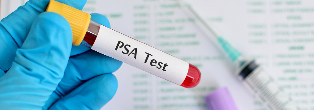 【Prostate】mHSPCの予後予測に有用なPSA指標、奏効率 vs 絶対値