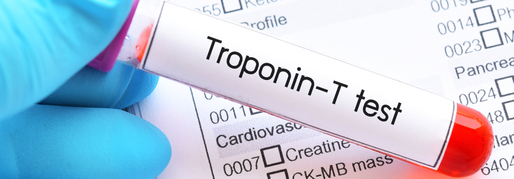 【J Immunother】ICI後の甲状腺機能異常では心筋トロポニン値が上昇