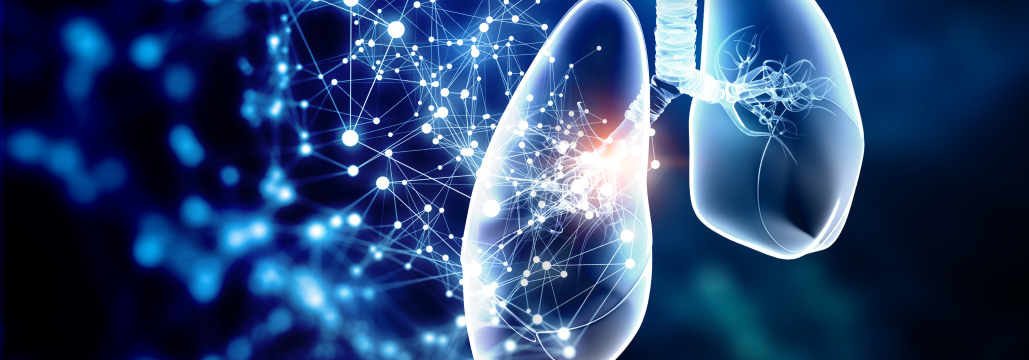 【Lung cancer】ED-SCLC、 B7-H3高発現は抗PD-L1抗体への抵抗性と関連か