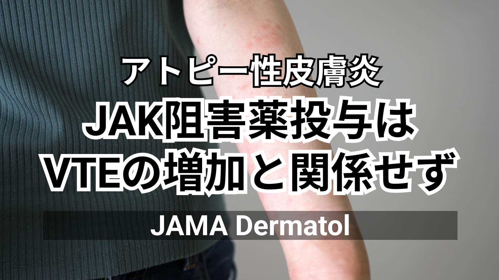 【JAMA Dermatol】アトピー性皮膚炎へのJAK阻害薬投与、静脈血栓塞栓症の増加と関係せず