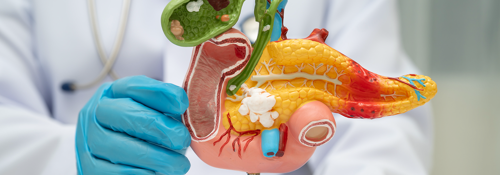 【膵管腺癌】放射線アブレーションは手術困難例の新たな選択肢となるか？