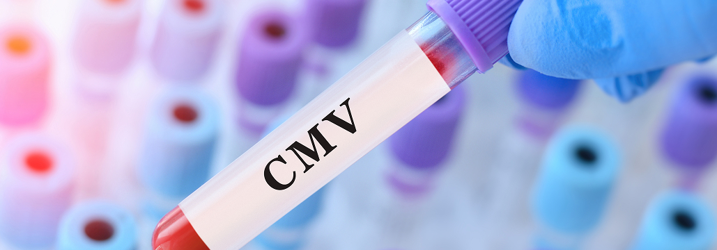 【AJOG】先天性CMV、 長期後遺症は妊娠第1三半期感染のみ