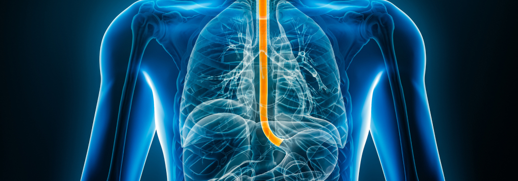 【EClinMed】ニボルマブ＋CRTでCR 73％､ 食道がん1次治療