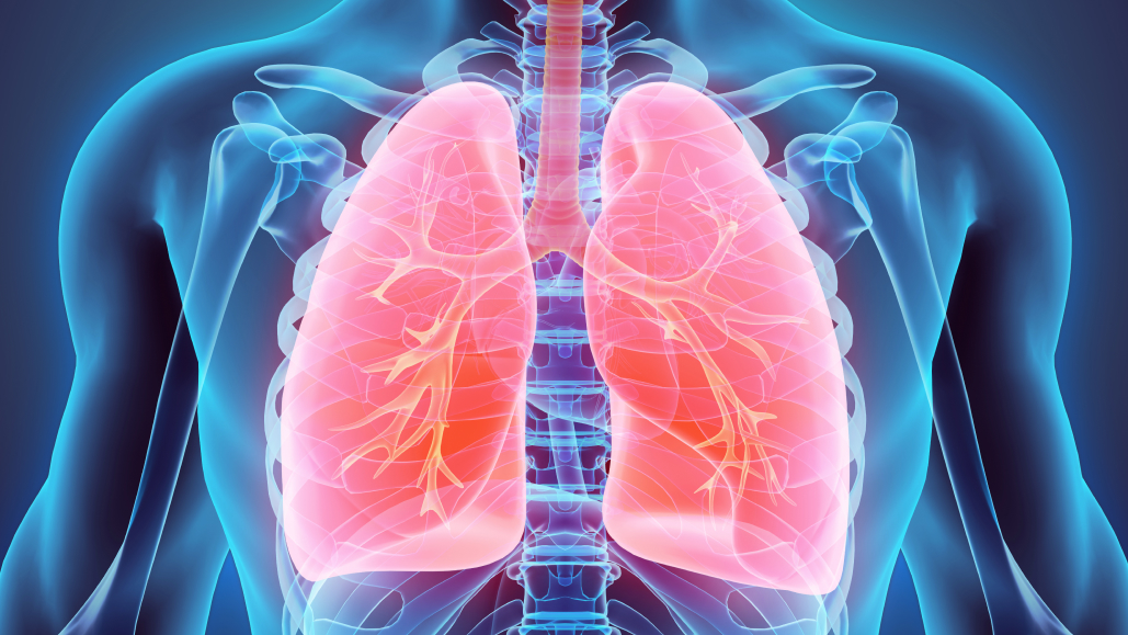 【JCO】Ⅲ期NSCLC : デュルバルマブのcCRT同時併用に上乗せ効果なし