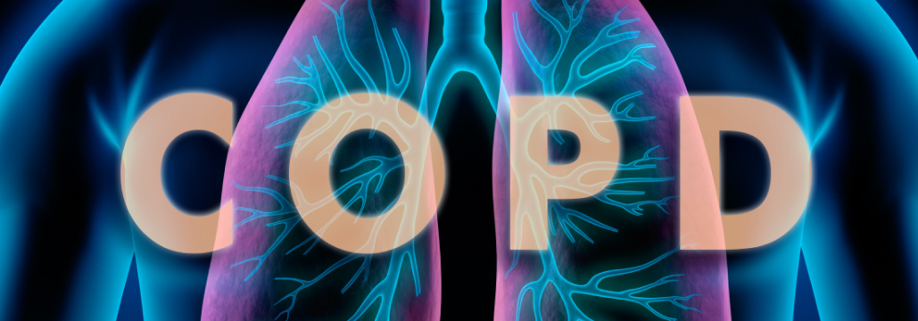 【ERJ Open Res】COPD､ 歩行速度低下で死亡リスク2.3倍