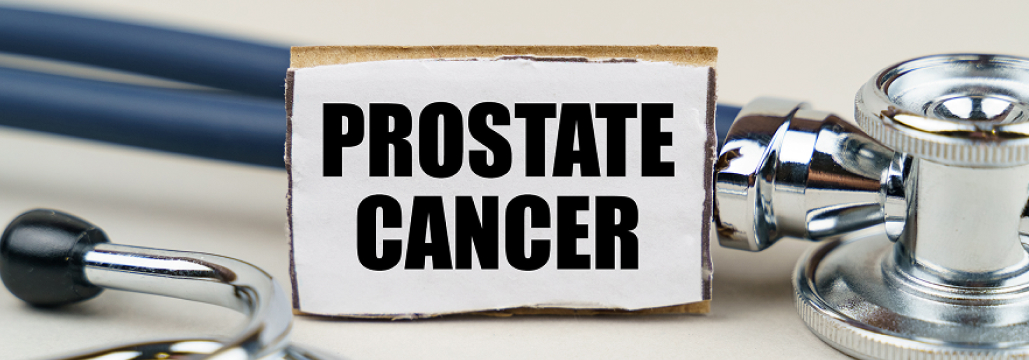 【Prostate】mHSPCに対するアパルタミド、 6ヵ月後のPSA値が予後を予測