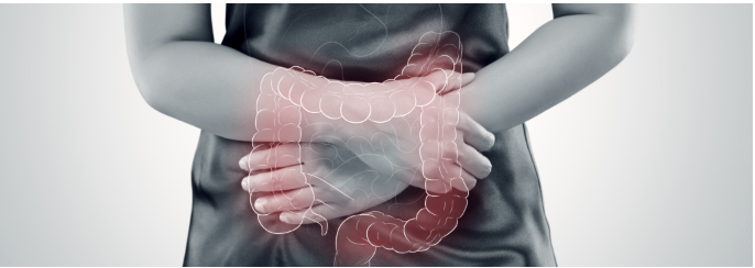 【NEJM】大腸癌､ 術後療法後の運動介入でDFS改善 : 第Ⅲ相CHALLENGE