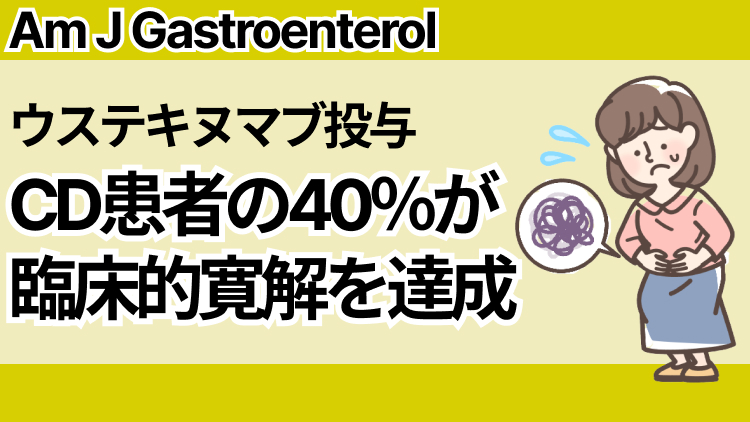 【Am J Gastroenterol】ウステキヌマブ投与､ Crohn病患者の40％が12カ月後臨床的寛解を達成