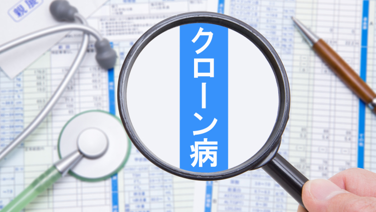 【NEJM】中等~重度クローン病、ウパダシチニブによる寛解導入および維持療法が有効