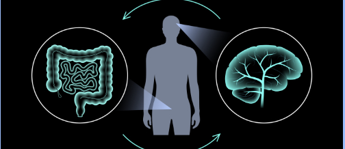 【Neurology】IBD患者は脳卒中発症の発症リスクが高い