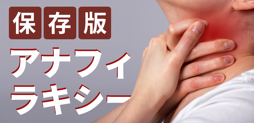 【人気】アナフィラキシー初期対応 ｢ステロイド投与は非推奨？｣