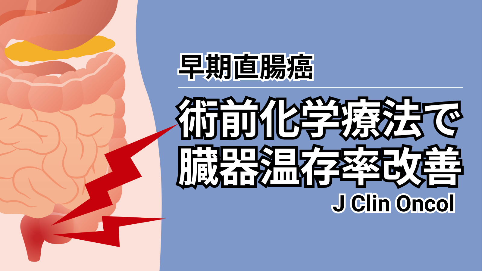 【J Clin Oncol】早期直腸癌患者への術前化学療法により臓器温存率が改善