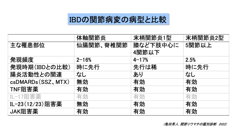 【好評配信中】IBDの最新トピックをライブ配信『KIWI』