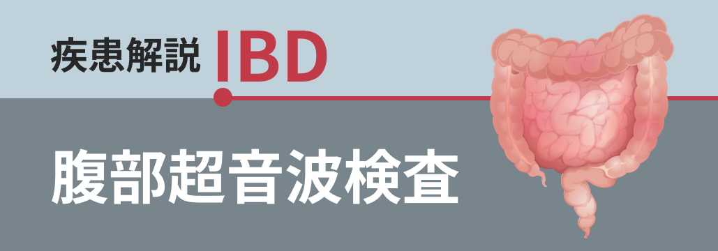 【IBDマニュアル】腹部超音波検査の有用性とポイント