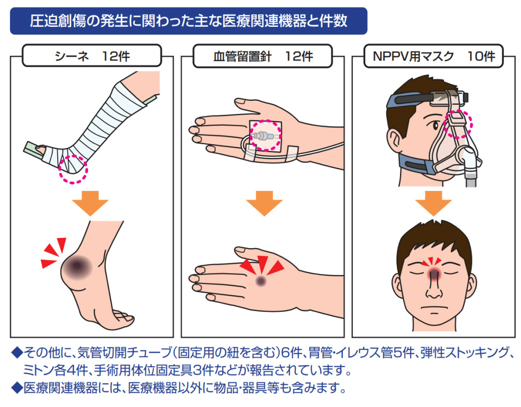 シーネや血管留置針による医療関連機器圧迫創傷に注意！ (日本医療機能評価機構)