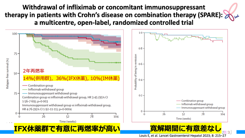 【KIWI】IBD注目論文 Best of 2023 (既存薬剤編①インフリキシマブ)