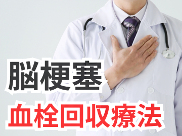 【最新治療がわかる！】脳梗塞人気コンテンツまとめ (計算ツール､専門医解説 他)