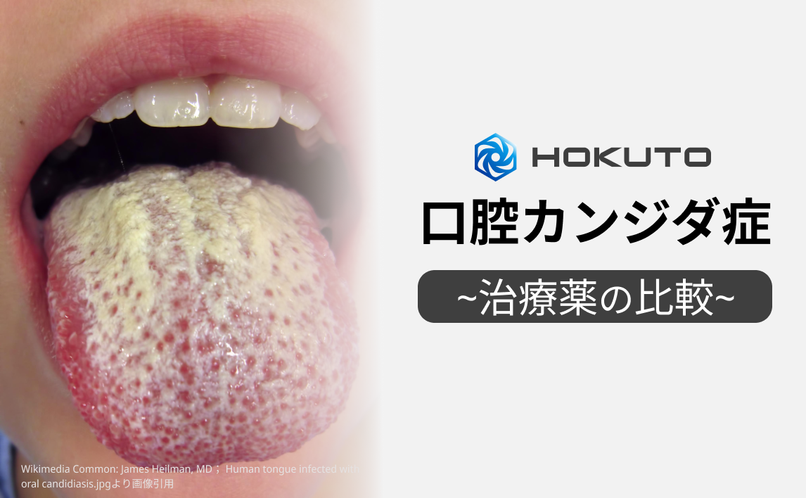 【口腔カンジダ症】治療薬４種類比較！使いやすい薬はどれ？ (2019年発売 オラビ他)