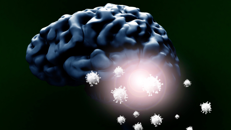 【Neurology】COVID-19に罹患した急性期脳梗塞患者は､ 頭蓋内出血を高合併