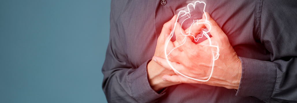 【NEJM】DES留置後AF患者､ NOAC単剤は併用療法に非劣性