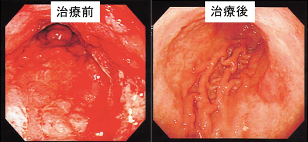  ｢がん薬物療法を未来につなぐ｣ 関西医科大･金井医師 (前編)