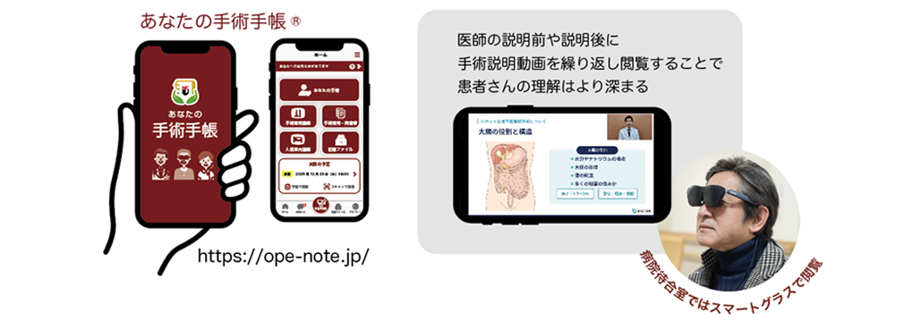 名古屋市立大病院、 外科医アバターが患者説明するアプリ開発、 業務負担4割減