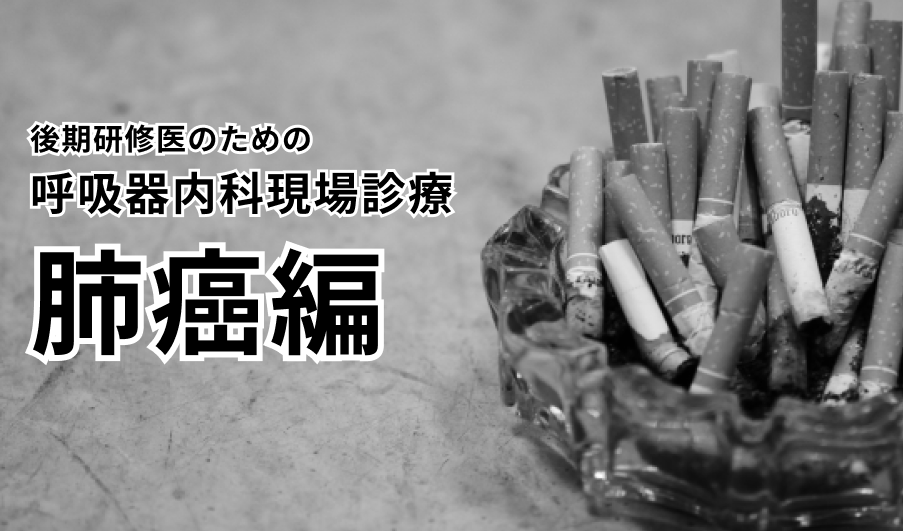 【肺癌】後期研修医のための呼吸器内科現場診療(日赤医療センター 粟野暢康先生)