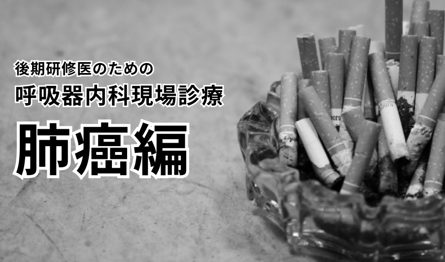 【肺癌】後期研修医のための呼吸器内科現場診療（日赤医療センター 粟野暢康先生）