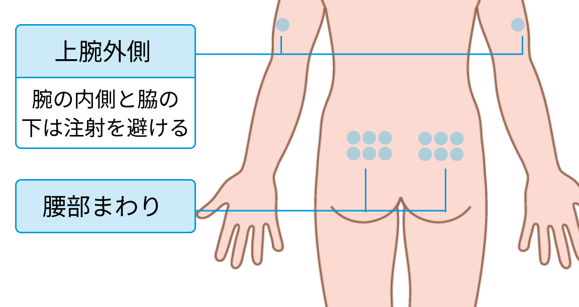 ハイゼントラの投与量計算