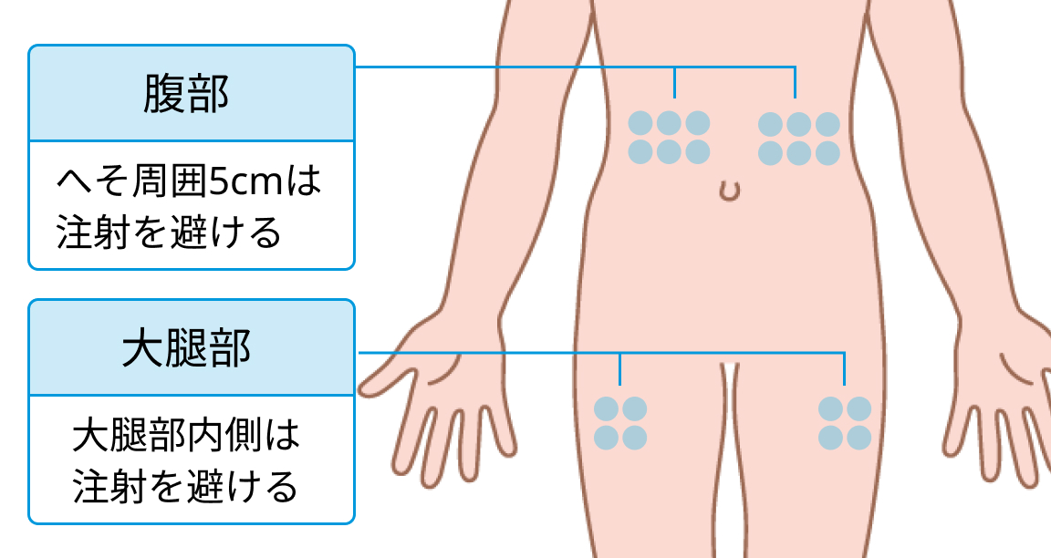 ハイゼントラの投与量計算