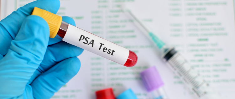 【JAMA】1回のPSA検診で15年時の前立腺癌特異的死亡率が微減