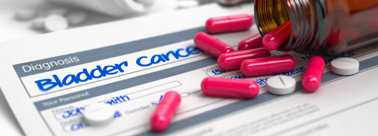 【BMC Cancer】尿路上皮癌へのペムブロリズマブ､国内市販後調査のデータは？