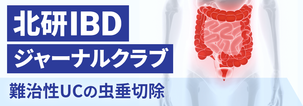 【解説】難治性UCの虫垂切除､ JAK阻害薬を上回る寛解導入効果