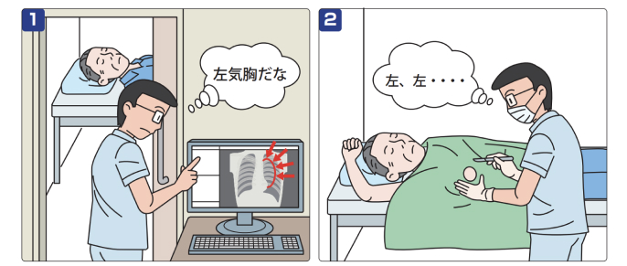 【なぜ?】胸腔ドレーンの左右取り違え