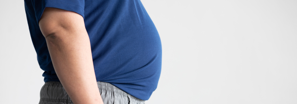 【Lancet】感染関連死亡の10%が肥満起因､ 55万例のコホートで推定