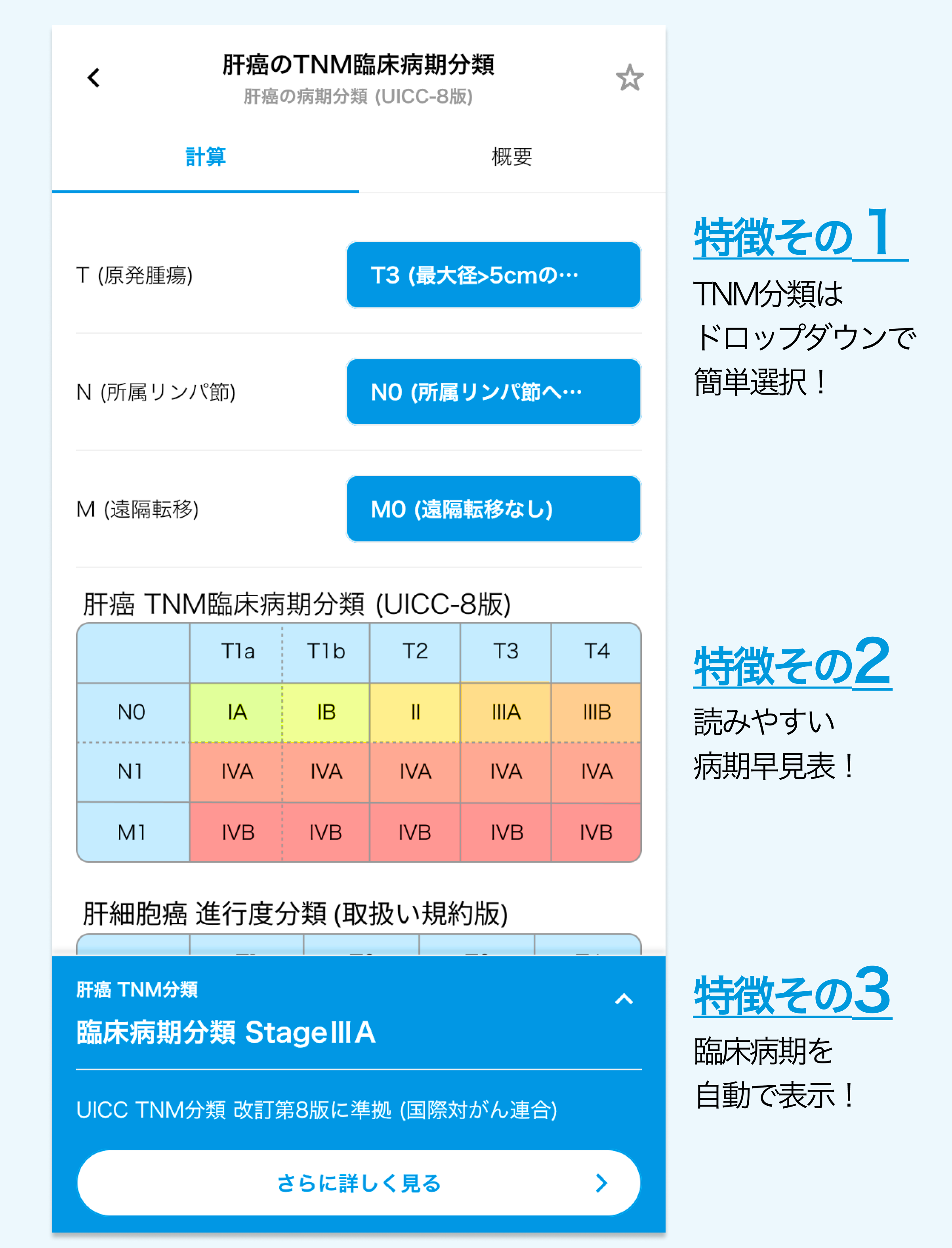 【肝癌 TNM分類】ツールを追加！UICC版と癌取扱い規約の違いも一目で確認