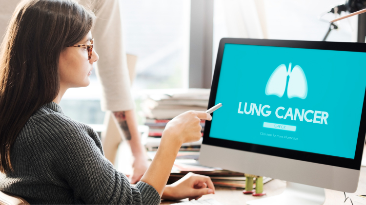 【Lung Cancer】高齢の進展型小細胞肺がん、カルボプラチン＋エトポシドが標準治療として適切：JCOG1201/TORG1528
