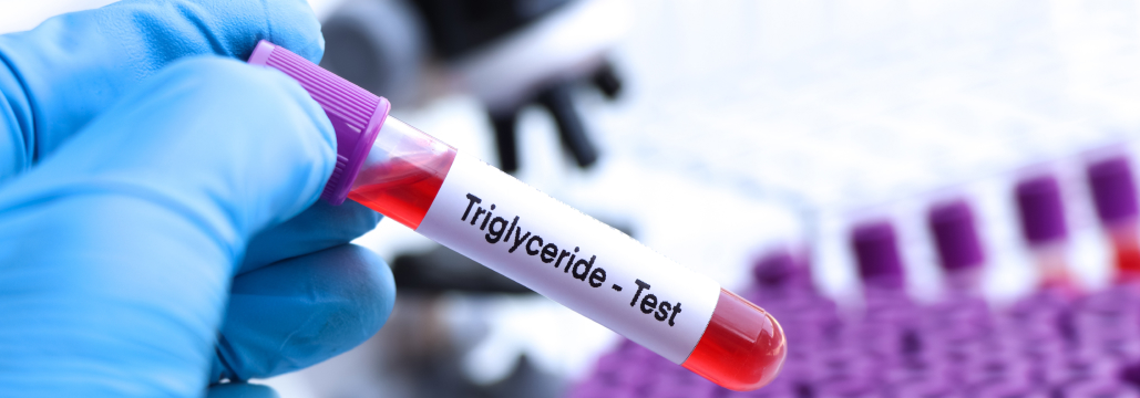 【Lancet】新規脂質低下薬候補ANGPTL4阻害抗体MAR001の安全性を確認