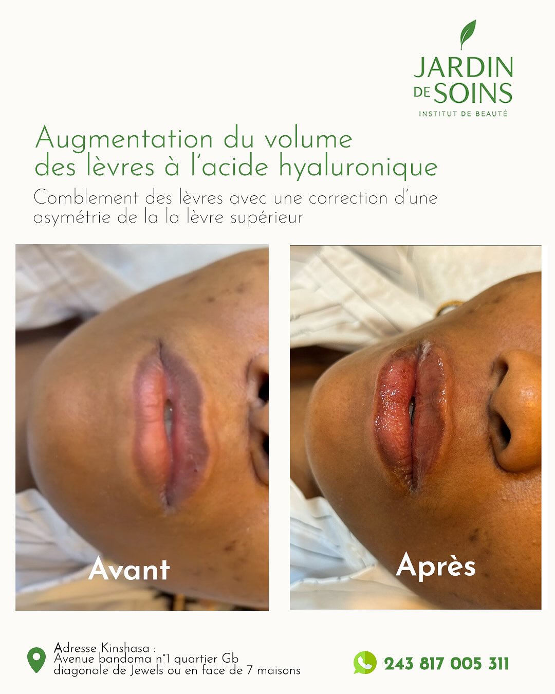Jardin des Soins