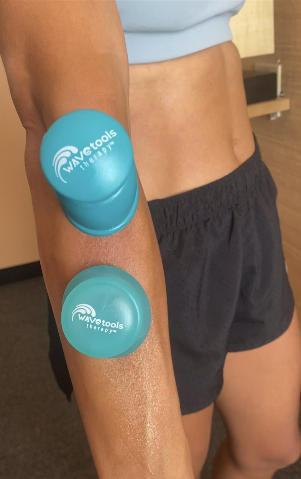 Cupping