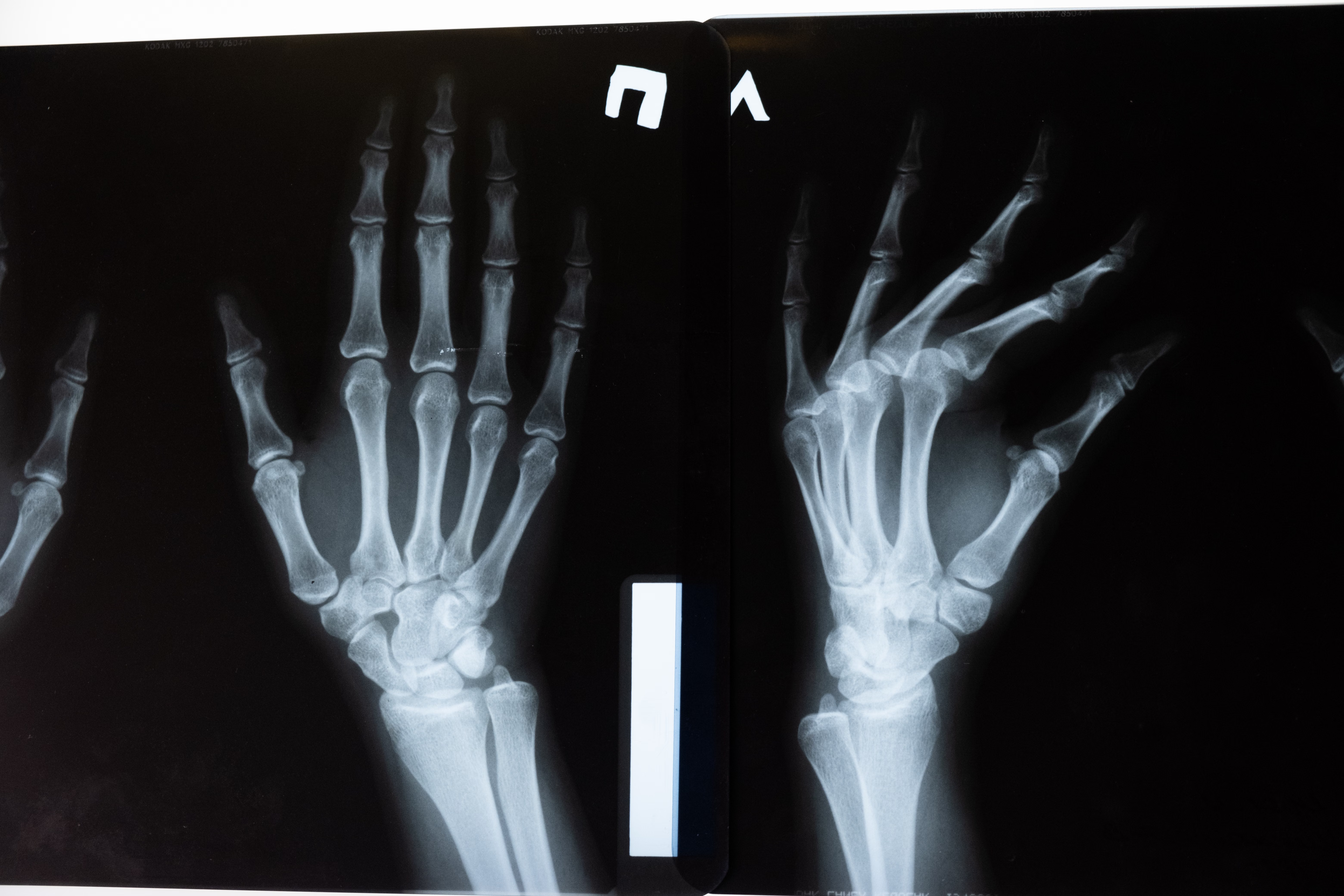 Top 5 Medical Imaging Datasets Driving Advances in Healthcare AI