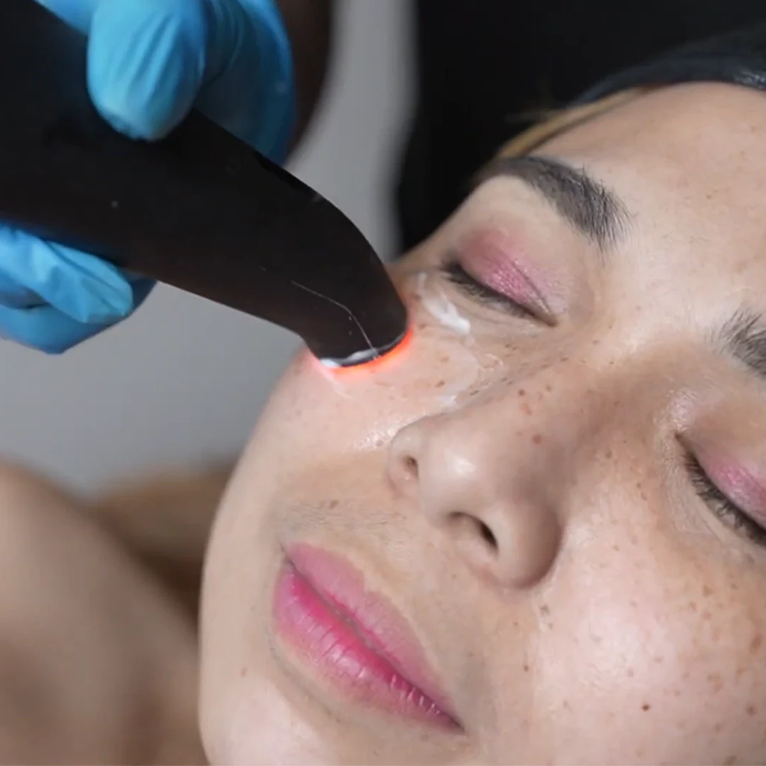 Iconique Eyelift360 Biophoton Lift Therapy