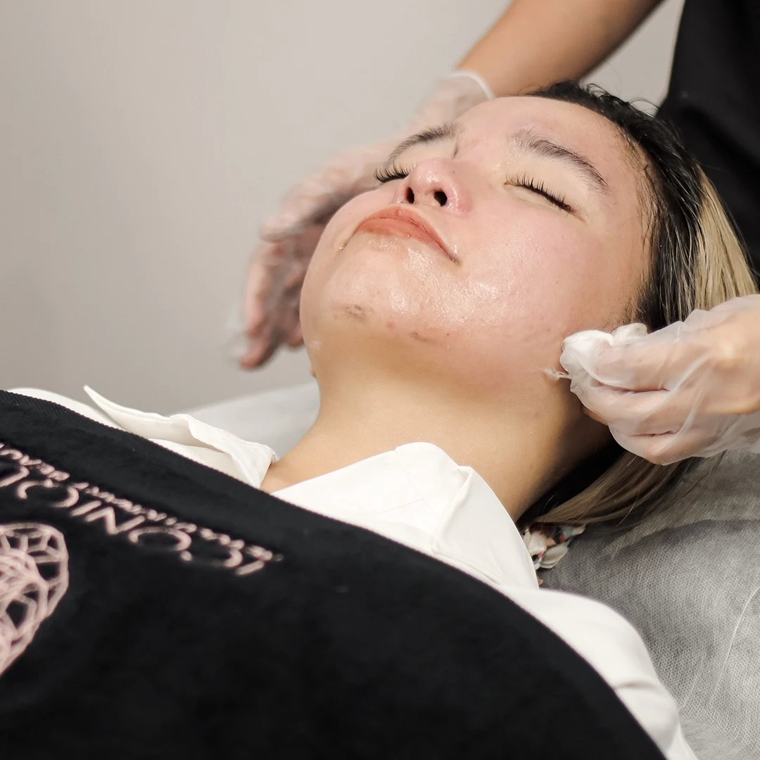 Iconique Hydrafacial Acne Defense